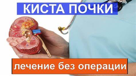 Киста почки диета Кисты почек КАК избавиться без операции - YouTube Кисты почек КАК избавиться без операции - YouTube Киста почки диета