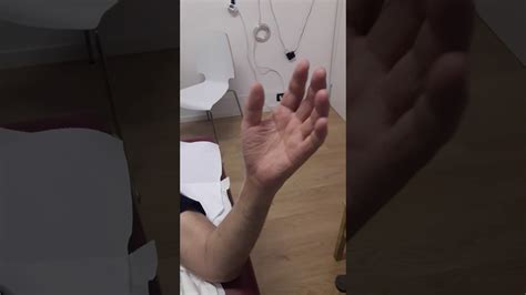 (Fisioterapia Minervini Roma) frattura polso: Fisioterapia ...