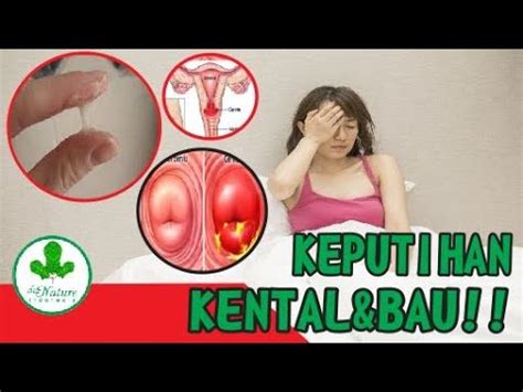 Dia hanya diam dan membuang muka, tapi dari wajahnya, kutahu dia tidak menampik dengan apa yang kuucapkan padanya. Vagina Keluar Keputihan Putih Kental Dan Gatal, Inilah ...