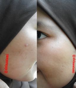 Produk kecantikan murah lihatlah koleksi produk kecantikan yang dapat anda buat dengan mudah di rumah. REVIEW: Fair & Lovely Krim Pencerah Harian Multivitamin ...