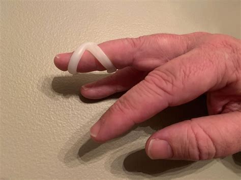 What is a Mallet Finger?