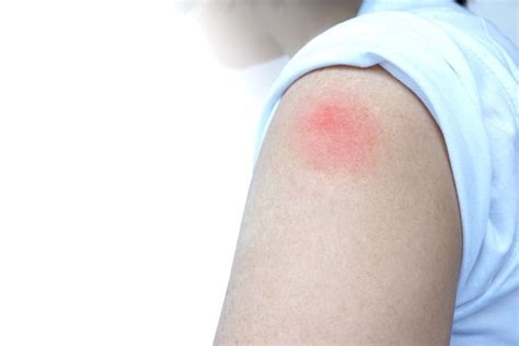 How long does a case of coronavirus last? Dr. Fauci Just Gave This Warning About COVID Vaccine Side ...
