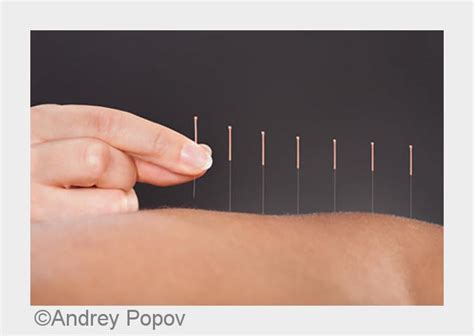 Check spelling or type a new query. Arzt Dr. Erhart / Schwäbisch Gmünd: Akupunktur gegen Burnout