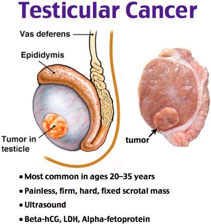 Sometimes, people with testicular cancer do not have any of these changes. 132 best oncology images on Pinterest | Being a nurse, Med ...