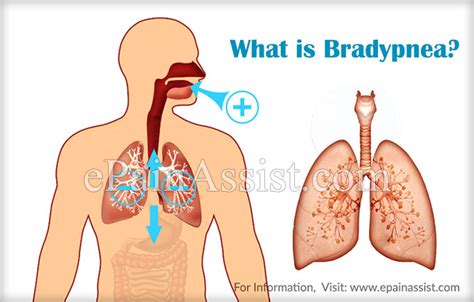 Bradypnea (or bradypnoea) is a condition that is characterized by an abnormally slow rate of breathing. Bradypnea|Causes|Symptoms|Treatment|Prognosis ...
