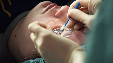 Listed below are general factors that increase endophthalmitis is a serious complication of cataract surgery involving microorganisms that gain entry into the eye. Pros and Cons of LASIK: Are the Risks Worth the Cost ...