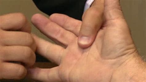Trigger finger can be treated with non-invasive procedure - ABC7 Los ...