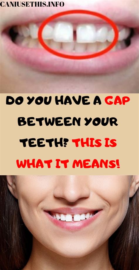 She asked her dentist but he didnt advise it. DO YOU HAVE A GAP BETWEEN YOUR TEETH? THIS IS WHAT IT ...
