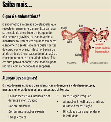 A endometriose é uma doença crônica que pode ser dolorosa. Somente 28% das curitibanas sabe o que é endometriose ...