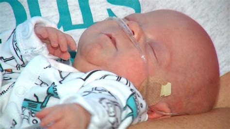 Babies born at 24 weeks have a 50 percent chance of survival, and that number is only going to get better as time goes on. Polk Co. Premature Baby, Born at 24 Weeks, Home at Last