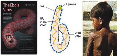 Early signs and symptoms include: General Information: Ebola Virus and Symptoms | Nepali ...