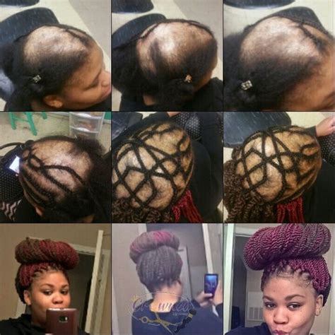 Hairstyles slick hairstyles baddie hairstyles slicked back ponytail mexican hairstyles brazilian curly hair individual braids edges hair heatless see more ideas about natural hair styles baddie hairstyles curly hair styles. For those suffering from alopecia, it doesn't have to be a ...