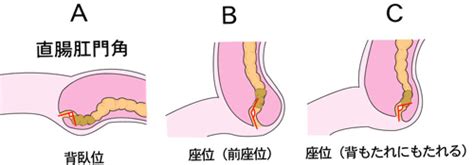 💩『うんこを楽に出す』には実はちょっとしたコツがある ...