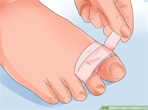 What are the symptoms and treatments? How to Treat a Stubbed Toe: When to Fix at Home, When to ...