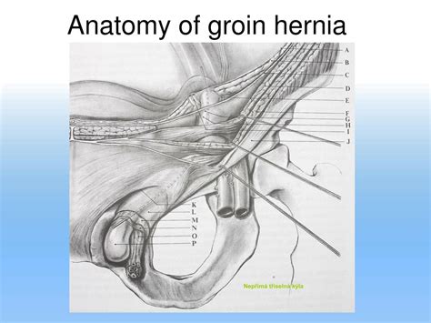 You can click the image to magnify if you cannot see clearly. PPT - ABDOMINAL HERNIAS AND SURGICAL MESHES PowerPoint Presentation, free download - ID:3380542