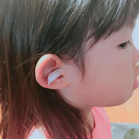 耳がかゆいのはなぜ？原因とおすすめの対処法を詳しくご紹介!