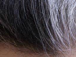 You can't alter your genetic makeup, however it is another major reason for premature hair graying, and every individual deals with stress from time to time. White pubic hair: Four possible causes