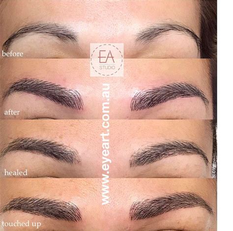 They should all works to refrain other software. Eyebrow Pigment Removal Near Me : Tattoo Removal - Tattoo eyebrow pigment removal eye line lip ...