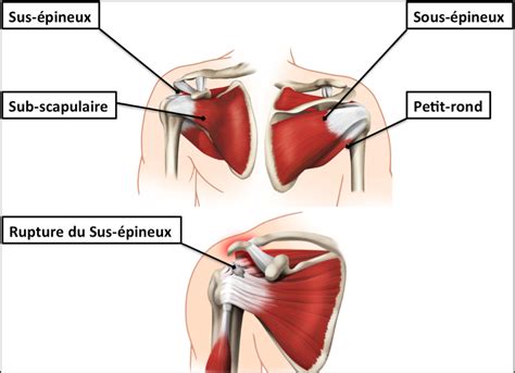 They come in many shapes and sizes, from small ones which enable. Lundi anatomie! La coiffe des rotateurs... - Clinique d ...