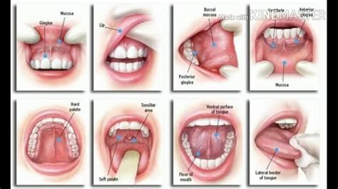 There are many different types of throat cancer. Warning signs of MOUTH CANCER - YouTube