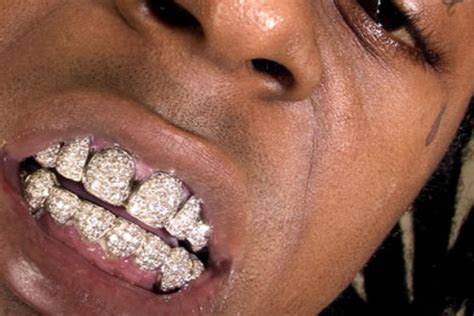 Dank einer behandlung hat er eine monat haftaufschub bekommen. Lil Wayne Zähne - Stockfoto Rapper Lil Wayne Wahrend Des ...