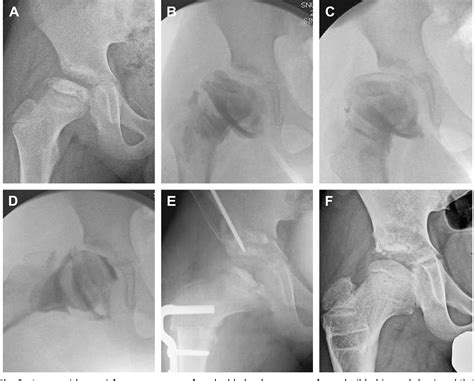 The disease that occurs in the initial. Figure 2 from Principles of treatment in late stages of ...