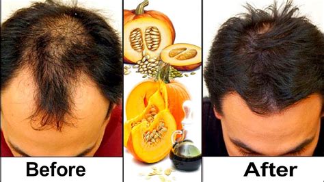 Explore a wide range of the best hair oil on aliexpress to find one that suits you! Pumpkin Seed Oil For Hair Growth - Should You Try Pumpkin ...