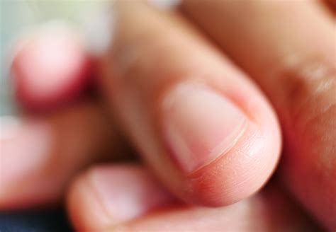 Having a healthy nail routine is a great idea to keep your nails looking their best. 6 Things Your Nails Say About Your Health - Health ...