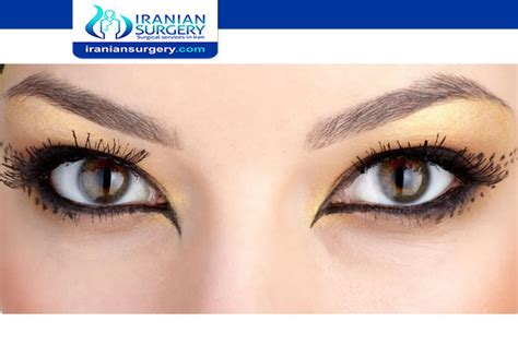 Along these lines, subtle enhancement of eye shape. cat eye surgery | Iranian Surgery