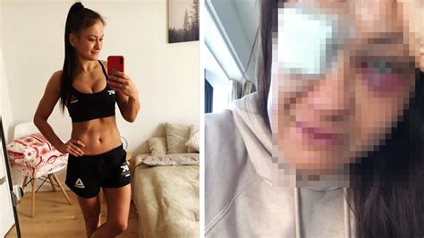 Check spelling or type a new query. Karolina Kowalkiewicz po UFC Auckland może stracić wzrok ...