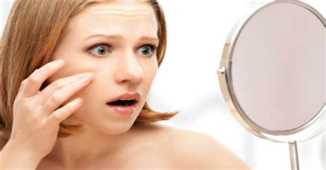 Cara Menghilangkan Jerawat Batu di Dagu, hidung, dan Dahi ...