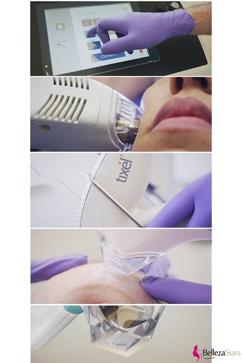 Tighten the skin and improve the appearance of scars and pigmentation with this new, innovative rejuvenation treatment. FRACTIONAL Tixel Scar Removal Machine BLS1273 - Beauty ...