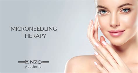 Microneedling and the vampire facial. Shedding Microneedling / Microneedling For Hair Loss What ...