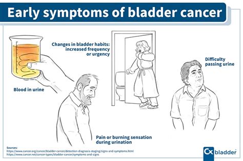It's more likely to be caused by a less serious condition, such as an infection. What Are the First Signs & Symptoms of Bladder Cancer?