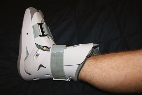 If you feel the wound is not healing normally, you should ask your veterinarian to examine it. How Long to Wear Air Cast for Sprained Ankle | Ten Reviewed