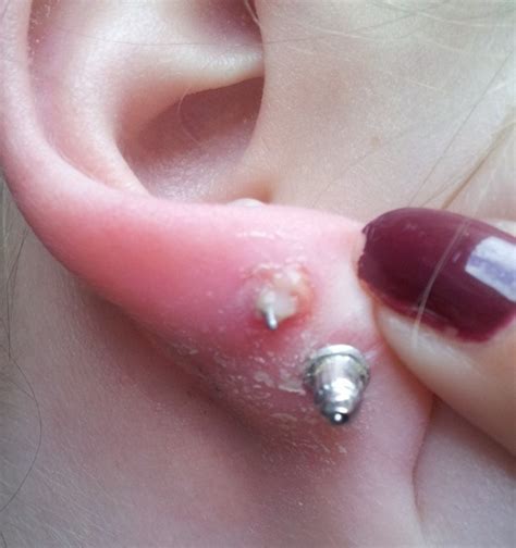 Auch wenn sie gesetzlich ohne probleme ihrem kind ein ohrloch stechen lassen können, haben sich viele piercingstudios und ärzte strengere regeln auferlegt als juristisch vorgegeben. Sabrina: Jetzt ist es passiert...