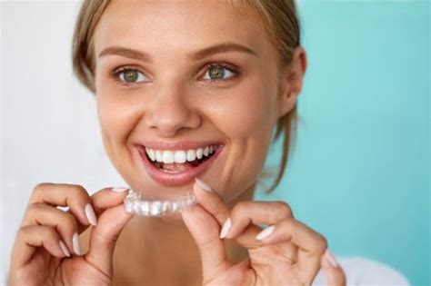 This plan could conceivably last for years. How Long Does Invisalign Take to Really Straighten Your ...