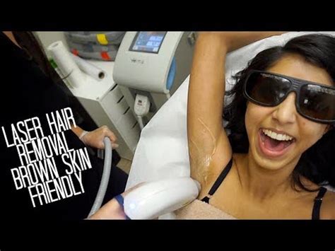 It had been performed experimentally for about twenty years before becoming commercially available in 1995 and 1996. My Experience With Laser Hair Removal (Brown/Black Skin ...