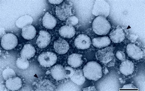 Sars is caused by a strain of coronavirus, the same family of viruses that causes the common cold. SARS - kapesní pandemie - Časopis Vesmír