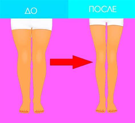 Как похудеть лежа в ногах