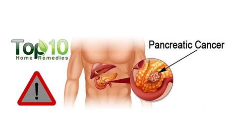 Early detection is key to pancreatic cancer and here's the scariest part of pancreatic cancer: 10 Warning Signs of Pancreatic Cancer that You Must Know ...