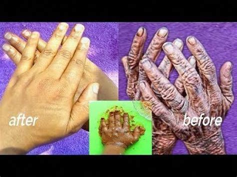 If the hair is light, try waxing. GET RID OF OLD LOOKING HANDS WRINKLES AND FINES LINES AND ...