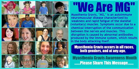 The term 'myasthenia gravis' (mg) comes from the greek word 'myasthenia' meaning muscle weakness and the latin word 'gravis' meaning severe. Ocular Myasthenia Gravis Icd 10