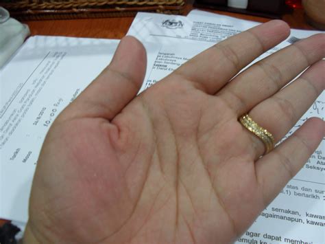 12 hal yang tanpa disadari membuat punggung kanan terasa sakit. love.love.love: gatal tapak tangan maknanya nk dapat duit kan??
