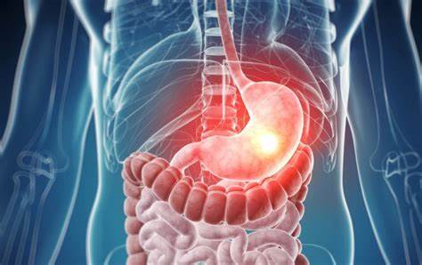 Язва двенадцатиперстной кишки: диагностика и лечение - Estet-Portal Картинка - Язва двенадцатиперстной кишки: диагностика и лечение - Estet-Portal