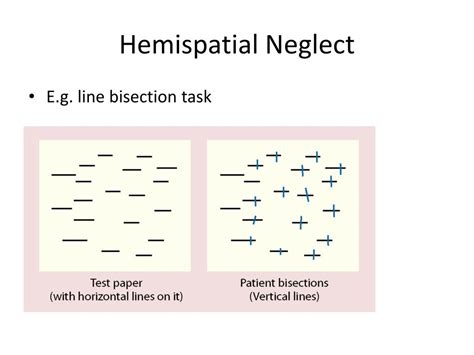 Usually, a displacement of the bisection mark towards the side of the brain lesion is interpreted as a symptom of neglect. PPT - Attention Orienting System and Associated Disorders ...