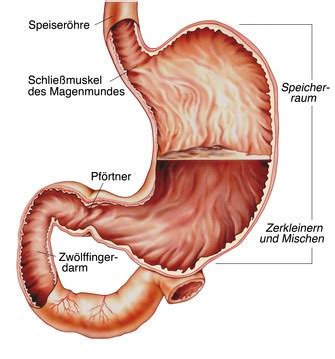 Some of the causes of gastroenteritis include viruses, bacteria, bacterial toxins, parasites, particular chemicals and some. Magen | Bauch.de