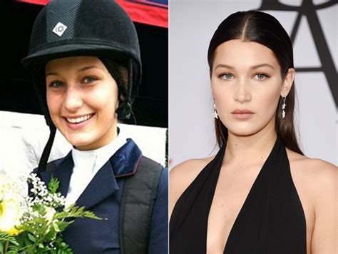 Has bella hadid had plastic surgery? Bella Hadid Plastic Surgery Before And After Photos