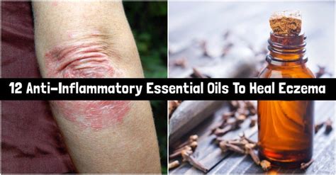 By reducing inflammation, ashwagandha helps balance blood sugar levels, ease anxiety, relieve adrenal fatigue and boost immune function. 12 Anti-Inflammatory Essential Oils To Heal Eczema