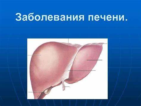 Заболевания печени симптомы и диета Заболевания печени. Основные симптомы и синдромы Заболевания печени. Основные симптомы и синдромы Заболевания печени симптомы и диета